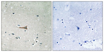 DDR1 (phospho Tyr513) rabbit pAb Antibody