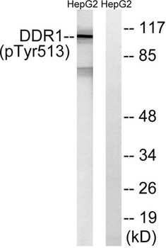 DDR1 (phospho Tyr513) rabbit pAb Antibody
