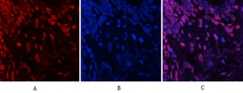 JNK1/2/3 (phospho Tyr185) rabbit pAb Antibody