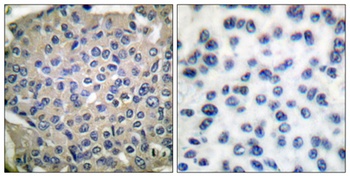 Cortactin (phospho Tyr466) rabbit pAb Antibody