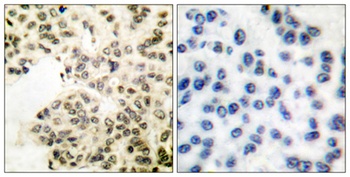 NFκB-p65 (phospho Ser311) rabbit pAb Antibody