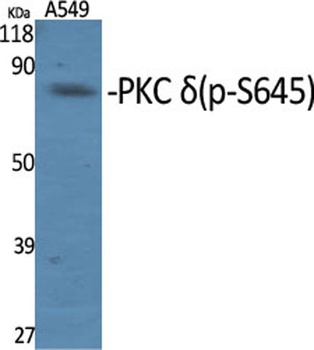 PKC δ (phospho Ser645) rabbit pAb Antibody