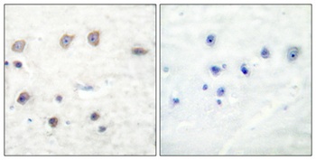 Adducin α/β (phospho Ser726/713) rabbit pAb Antibody