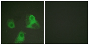 Adducin α/β (phospho Ser726/713) rabbit pAb Antibody