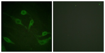 Cytokeratin 18 (phospho Ser33) rabbit pAb Antibody