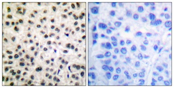 MEF-2 (phospho Ser408) rabbit pAb Antibody