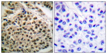 NFκB-p105 (phospho Ser927) rabbit pAb Antibody