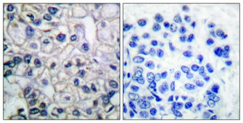 IGF-IR (phospho Tyr1161) rabbit pAb Antibody