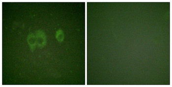IGF-IR (phospho Tyr1161) rabbit pAb Antibody