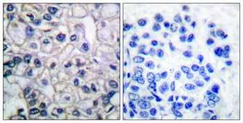IGF-IR (phospho Tyr1161) rabbit pAb Antibody