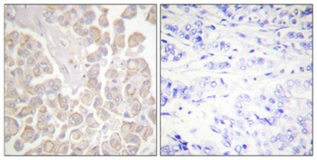 Crk-L (phospho Tyr207) rabbit pAb Antibody