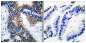 Crk-L (phospho Tyr207) rabbit pAb Antibody