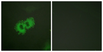 Caldesmon (phospho Ser789) rabbit pAb Antibody