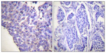 Caldesmon (phospho Ser789) rabbit pAb Antibody