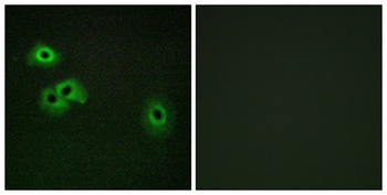 Calmodulin (phospho Thr80/S82) rabbit pAb Antibody