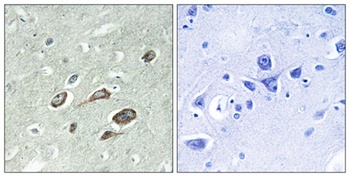 Calmodulin (phospho Thr80/S82) rabbit pAb Antibody