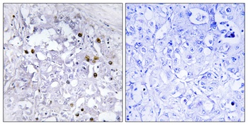 HNF4-α (phospho Ser313) rabbit pAb Antibody