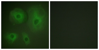 14-3-3 θ/τ rabbit pAb Antibody