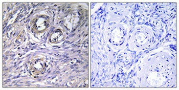 ABHD12 rabbit pAb Antibody