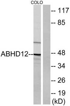 ABHD12 rabbit pAb Antibody