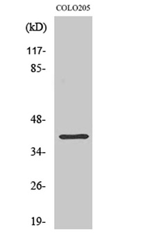 ABHD6 rabbit pAb Antibody