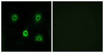 ABHD6 rabbit pAb Antibody