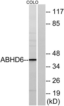 ABHD6 rabbit pAb Antibody