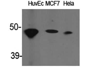 ACAT-1 rabbit pAb Antibody