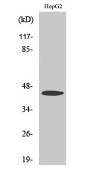 ACAT-1 rabbit pAb Antibody