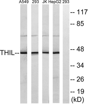 ACAT-1 rabbit pAb Antibody