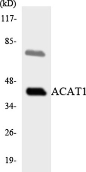 ACAT-1 rabbit pAb Antibody