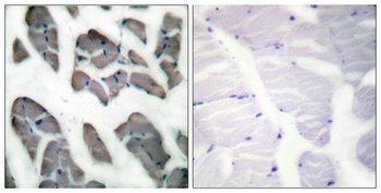 Actin α3 rabbit pAb Antibody