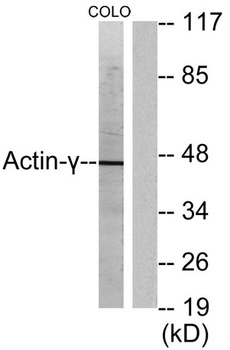 Actin α3 rabbit pAb Antibody