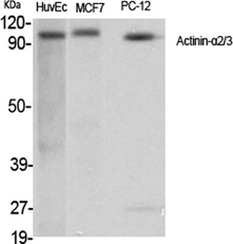 Actinin-α2/3 rabbit pAb Antibody