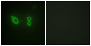 Actinin-α2/3 rabbit pAb Antibody