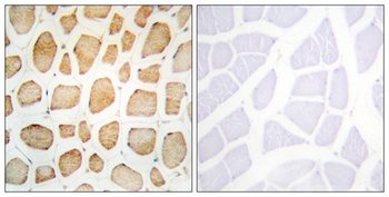 Actinin-α2/3 rabbit pAb Antibody