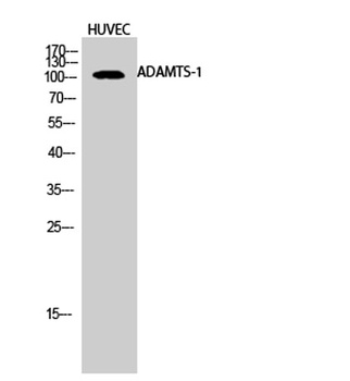 ADAMTS-1 rabbit pAb Antibody
