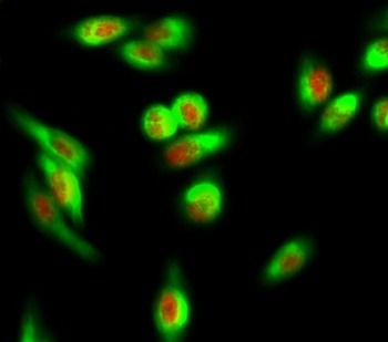 AF-10 rabbit pAb Antibody