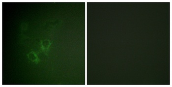 Ah Receptor rabbit pAb Antibody