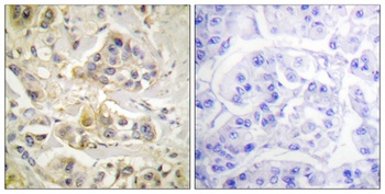 Ah Receptor rabbit pAb Antibody