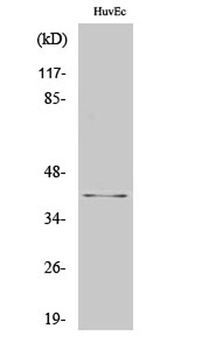AIM2 rabbit pAb Antibody