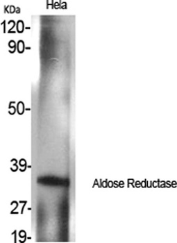 Aldose Reductase rabbit pAb Antibody