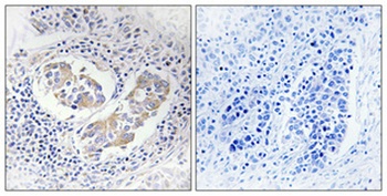 Aldose Reductase rabbit pAb Antibody