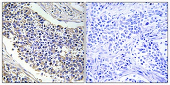 Aldose Reductase rabbit pAb Antibody