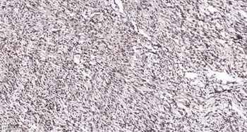 ALX3 rabbit pAb Antibody