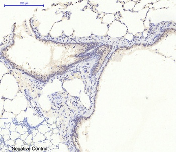 AMPKα1 rabbit pAb Antibody