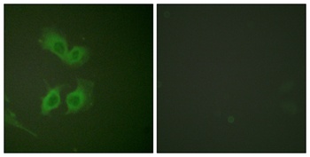 Amyloid-β rabbit pAb Antibody