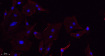 Annexin VI rabbit pAb Antibody