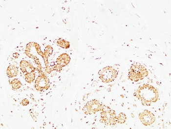 AP-2γ rabbit pAb Antibody