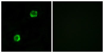 ApoL2 rabbit pAb Antibody